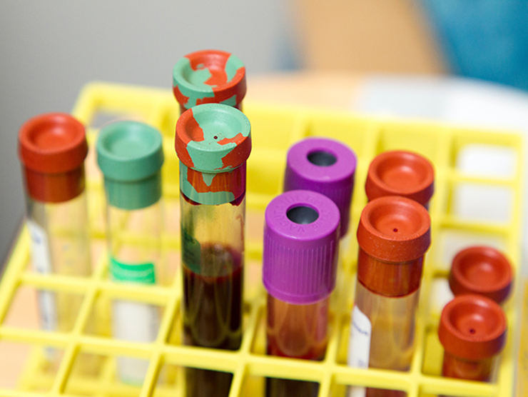 Medical laboratory test tubes