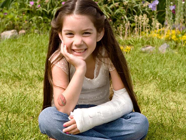 girl with broken arm outside for a summer activity