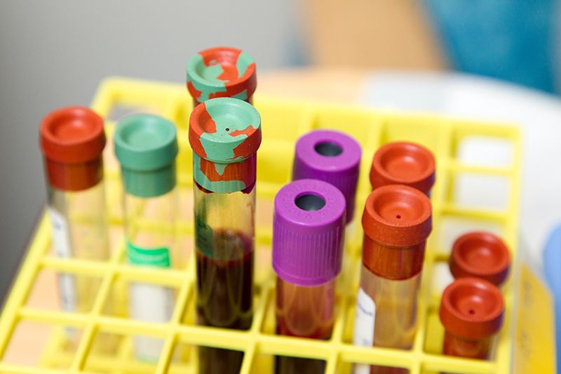 Medical laboratory test tubes