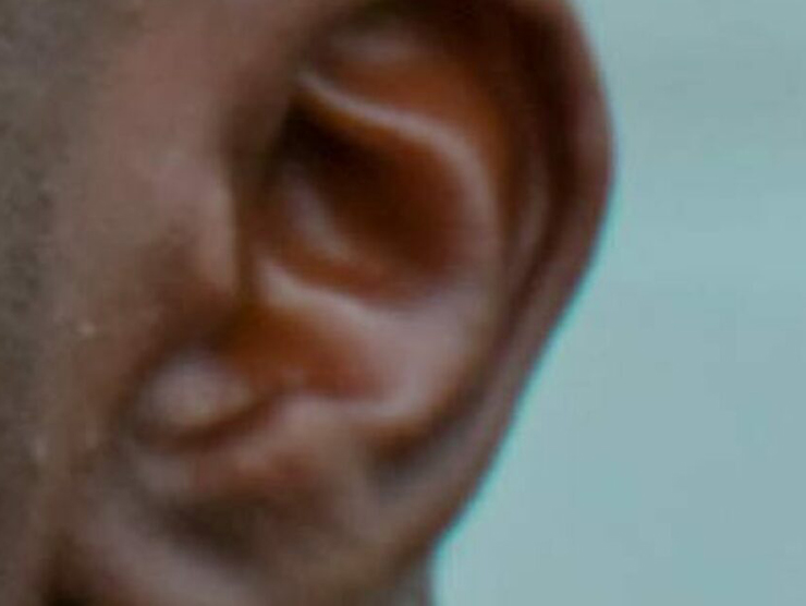 Zoomed image of a toddlers ear 
